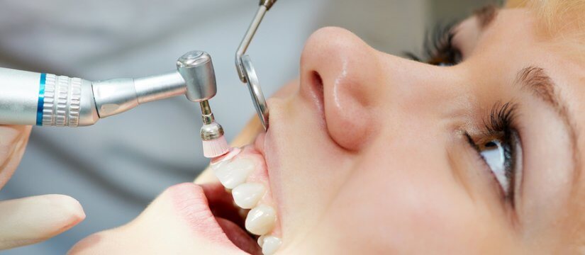 a-guide-to-deep-dental-cleaning