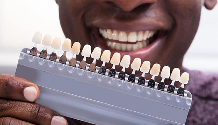 everything-you-need-to-know-about-dental-implants